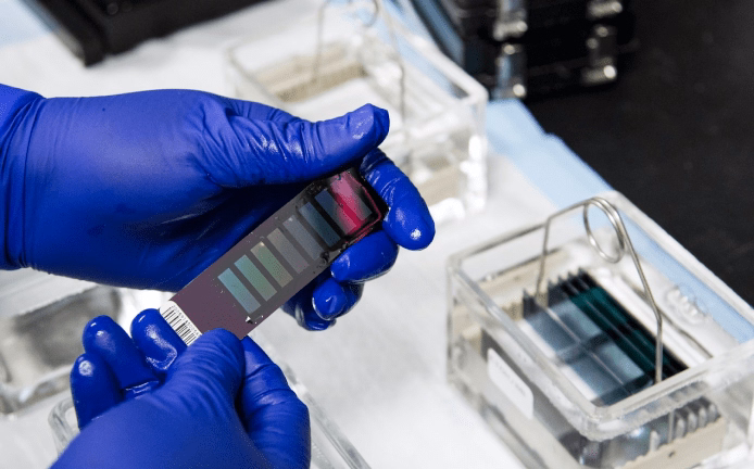 ENDOTYPE RESPONSE & PERSONALIZED MEDICINE